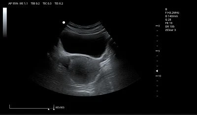 product-1-1 bladder & Uterus(001)