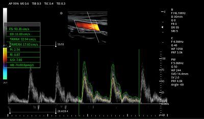 product-1-1 CCA PW Auto trace(001)