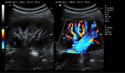 product-1-1 Kidney B &C Mode 1(001)